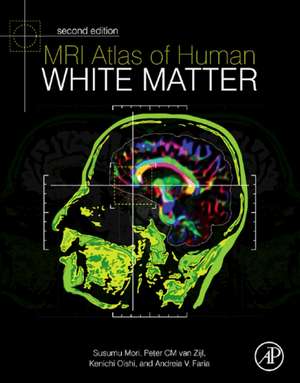 MRI Atlas of Human White Matter de Kenichi Oishi