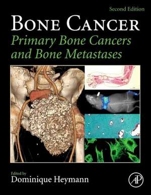 Bone Cancer: Primary Bone Cancers and Bone Metastases de Dominique Heymann