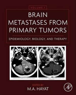 Brain Metastases from Primary Tumors Volume 1: Epidemiology, Biology, and Therapy de M. A. Hayat