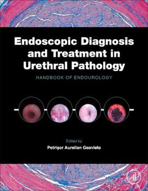 Endoscopic Diagnosis and Treatment in Urethral Pathology: Handbook of Endourology de Petrisor Aurelian Geavlete