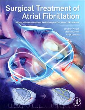 Surgical Treatment of Atrial Fibrillation: A Comprehensive Guide to Performing the Cox Maze IV Procedure de Jonathan Philpott