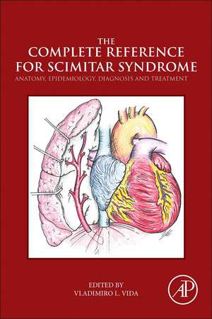 The Complete Reference for Scimitar Syndrome: Anatomy, Epidemiology, Diagnosis and Treatment de Vladimiro Vida