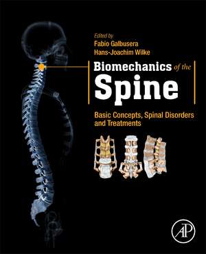 Biomechanics of the Spine: Basic Concepts, Spinal Disorders and Treatments de Fabio Galbusera