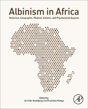 Albinism in Africa: Historical, Geographic, Medical, Genetic, and Psychosocial Aspects de Jennifer Kromberg