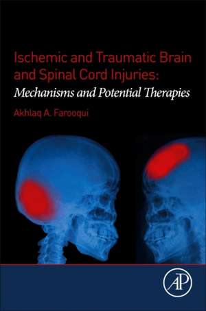 Ischemic and Traumatic Brain and Spinal Cord Injuries: Mechanisms and Potential Therapies de Akhlaq A. Farooqui