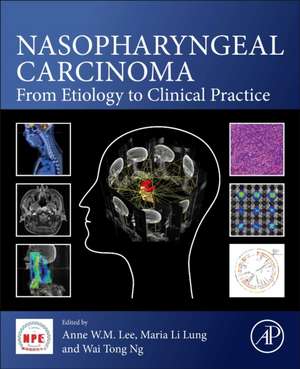 Nasopharyngeal Carcinoma: From Etiology to Clinical Practice de Anne W.M. Lee