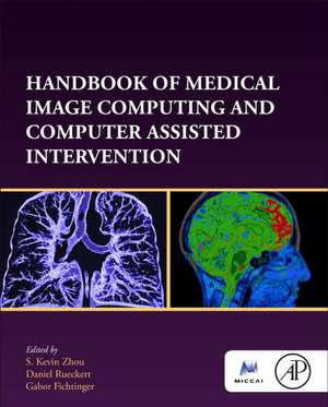 Handbook of Medical Image Computing and Computer Assisted Intervention de S. Kevin Zhou