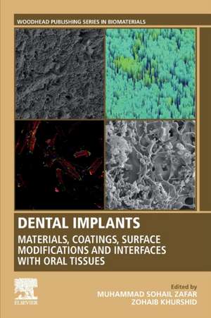 Dental Implants: Materials, Coatings, Surface Modifications and Interfaces with Oral Tissues de Muhammad Zafar