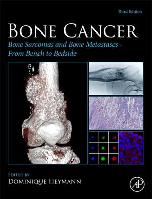 Bone Cancer: Bone Sarcomas and Bone Metastases - From Bench to Bedside de Dominique Heymann