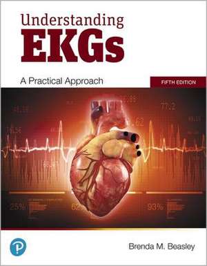 Understanding EKGs de Brenda Beasley