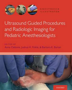 Ultrasound Guided Procedures and Radiologic Imaging for Pediatric Anesthesiologists alte