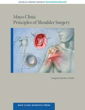 Mayo Clinic Principles of Shoulder Surgery de Joaquin Sanchez-Sotelo