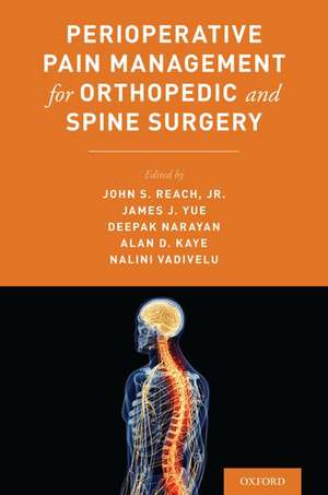 Perioperative Pain Management for Orthopedic and Spine Surgery de John Reach