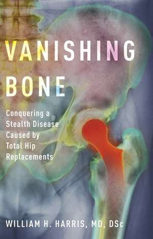 Vanishing Bone: Conquering a Stealth Disease Caused by Total Hip Replacements de William H. Harris