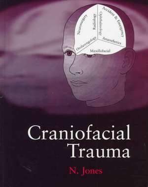 Craniofacial Trauma: An Interdisciplinary Approach de Nick Jones