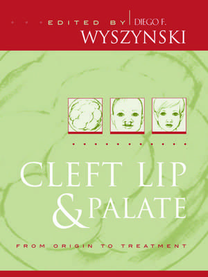 Cleft Lip and Palate: From Origin to Treatment de Diego F. Wyszynski