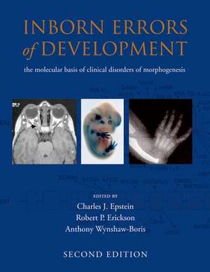 Inborn Errors of Development: The molecular basis of clinical disorders of morphogenesis de Charles J. Epstein