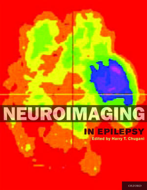 Neuroimaging in Epilepsy de Harry Chugani, MD