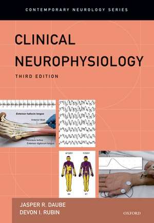 Clinical Neurophsyiology [With CDROM]: The Lost World of Stalin's Special Settlements de Jasper Daube