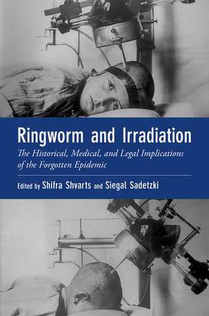 Ringworm and Irradiation: The Historical, Medical, and Legal Implications of the Forgotten Epidemic de Shifra Shvarts