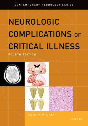 Neurologic Complications of Critical Illness de Eelco F.M. Wijdicks