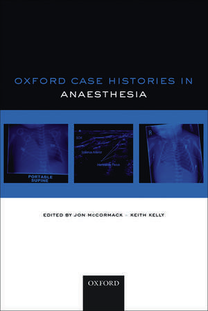 Oxford Case Histories in Anaesthesia de Jon McCormack