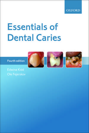 Essentials of Dental Caries de Edwina Kidd