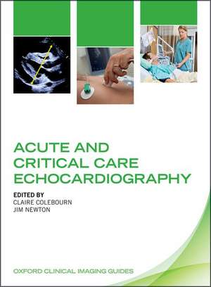 Acute and Critical Care Echocardiography de Claire Colebourn