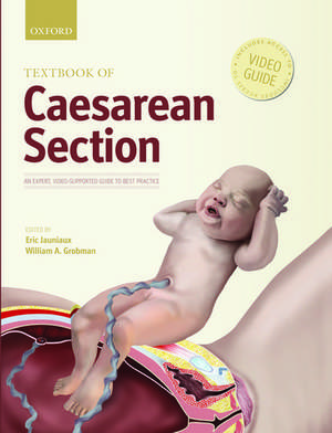 Textbook of Caesarean Section de Eric Jauniaux