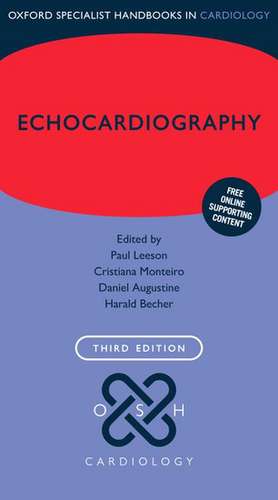 Echocardiography de Paul Leeson