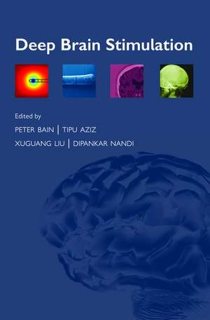 Deep Brain Stimulation de Peter Bain