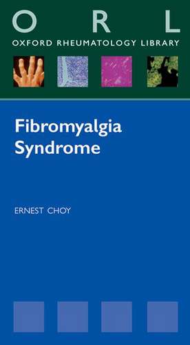 Fibromyalgia Syndrome de Ernest Choy