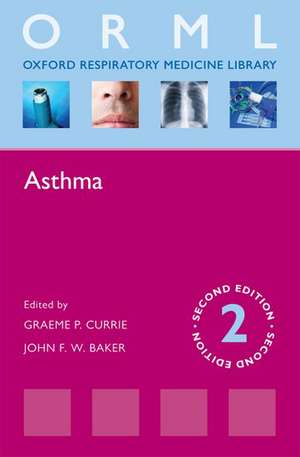 Asthma de Graeme P. Currie