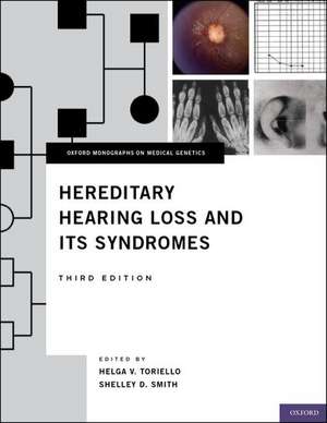 Hereditary Hearing Loss and Its Syndromes de Helga V. Toriello