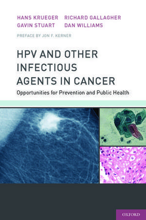 HPV and Other Infectious Agents in Cancer: Opportunities for Prevention and Public Health de Hans Krueger