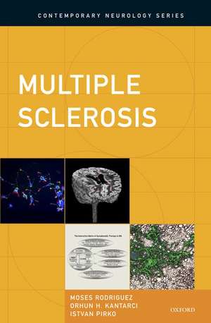 Multiple Sclerosis de Moses Rodriguez