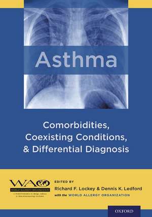 Asthma: Comorbidities, Coexisting Conditions, and Differential Diagnosis de Richard F. Lockey