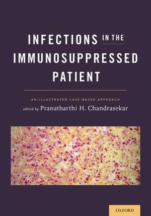 Infections in the Immunosuppressed Patient: An Illustrated Case-Based Approach de Pranatharthi H. Chandrasekar