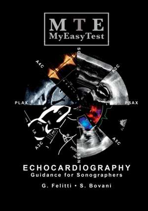 Echocardiography - MyEasyTest de Giuseppe Felitti