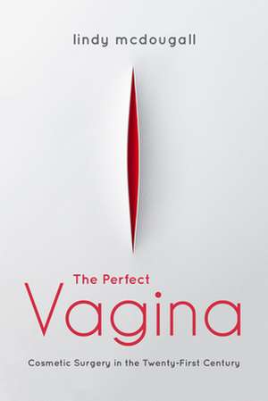 The Perfect Vagina – Cosmetic Surgery in the Twenty–First Century de Lindy Mcdougall