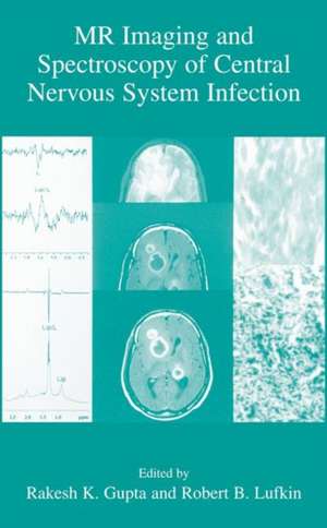 MR Imaging and Spectroscopy of Central Nervous System Infection de Rakesh K. Gupta