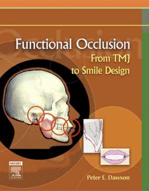 Functional Occlusion: From TMJ to Smile Design de Peter E. Dawson