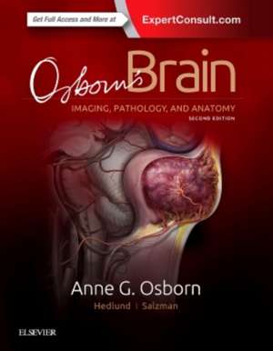 Osborn's Brain de Anne G. Osborn