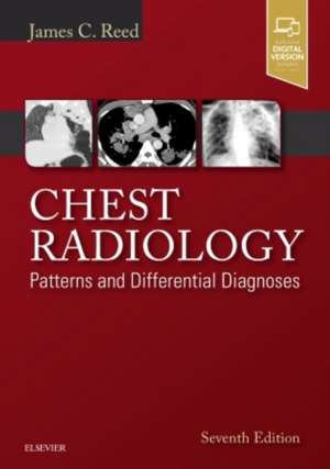 Chest Radiology: Patterns and Differential Diagnoses de James C. Reed