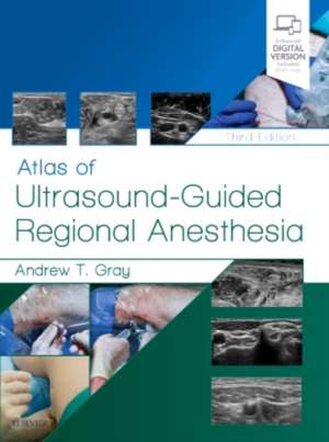 Atlas of Ultrasound-Guided Regional Anesthesia de Andrew T. Gray