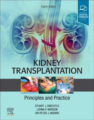 Kidney Transplantation - Principles and Practice de Stuart J. Knechtle