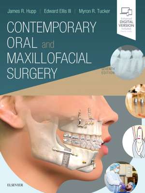 Contemporary Oral and Maxillofacial Surgery de James R. Hupp