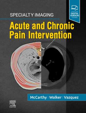 Specialty Imaging: Acute and Chronic Pain Intervention de Colin J. McCarthy