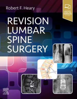 Revision Lumbar Spine Surgery de Robert F. Heary