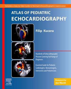 Atlas of Pediatric Echocardiography de Filip Kucera